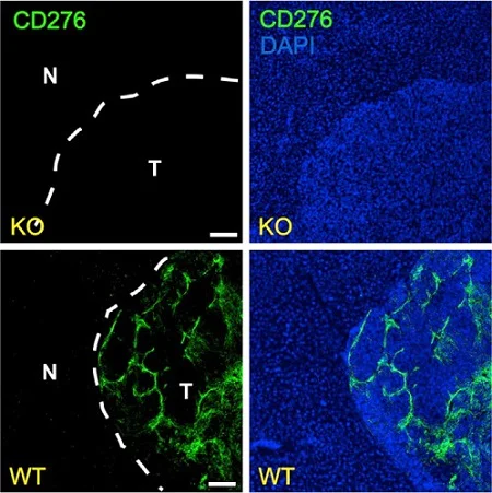 Immunohistochemistry (Frozen sections) - Anti-CD276 antibody [EPNCIR122] - BSA and Azide free (AB256585)
