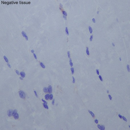 Immunohistochemistry (Formalin/PFA-fixed paraffin-embedded sections) - Anti-CD276 antibody [EPR20115] (ab219648), expandable thumbnail