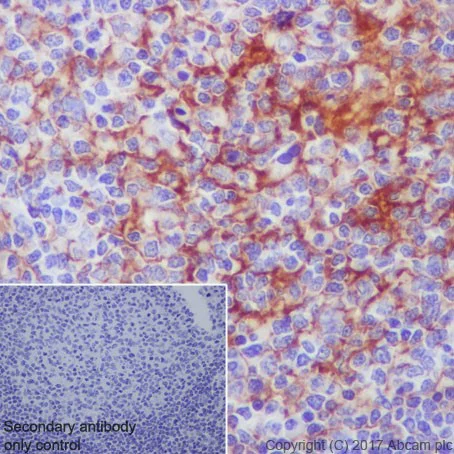 Immunohistochemistry (Formalin/PFA-fixed paraffin-embedded sections) - Anti-CD276 antibody [EPR20115] (AB219648)