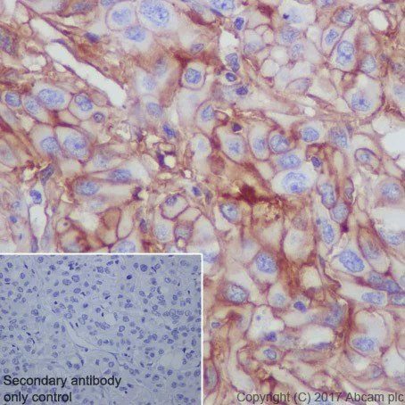 Immunohistochemistry (Formalin/PFA-fixed paraffin-embedded sections) - Anti-CD276 antibody [EPR20115] (AB219648)