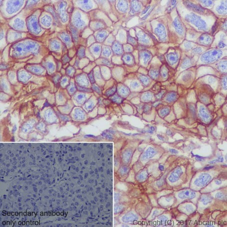 Immunohistochemistry (Formalin/PFA-fixed paraffin-embedded sections) - Anti-CD276 antibody [EPR20115] (ab219648), expandable thumbnail
