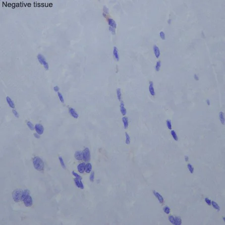 Immunohistochemistry (Formalin/PFA-fixed paraffin-embedded sections) - Anti-CD276 antibody [EPR20115] - BSA and Azide free (AB227577)