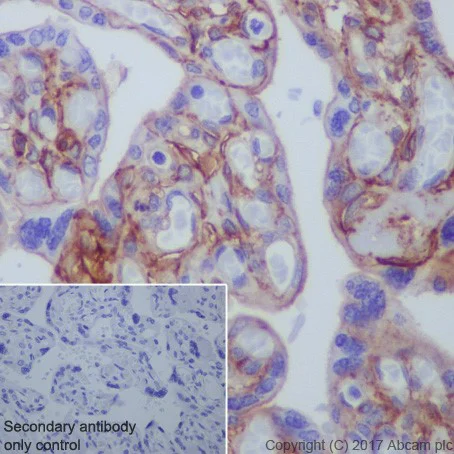 Immunohistochemistry (Formalin/PFA-fixed paraffin-embedded sections) - Anti-CD276 antibody [EPR20115] - BSA and Azide free (AB227577)