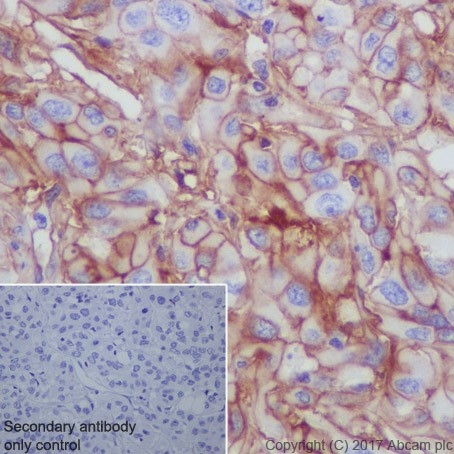Immunohistochemistry (Formalin/PFA-fixed paraffin-embedded sections) - Anti-CD276 antibody [EPR20115] - BSA and Azide free (AB227577)