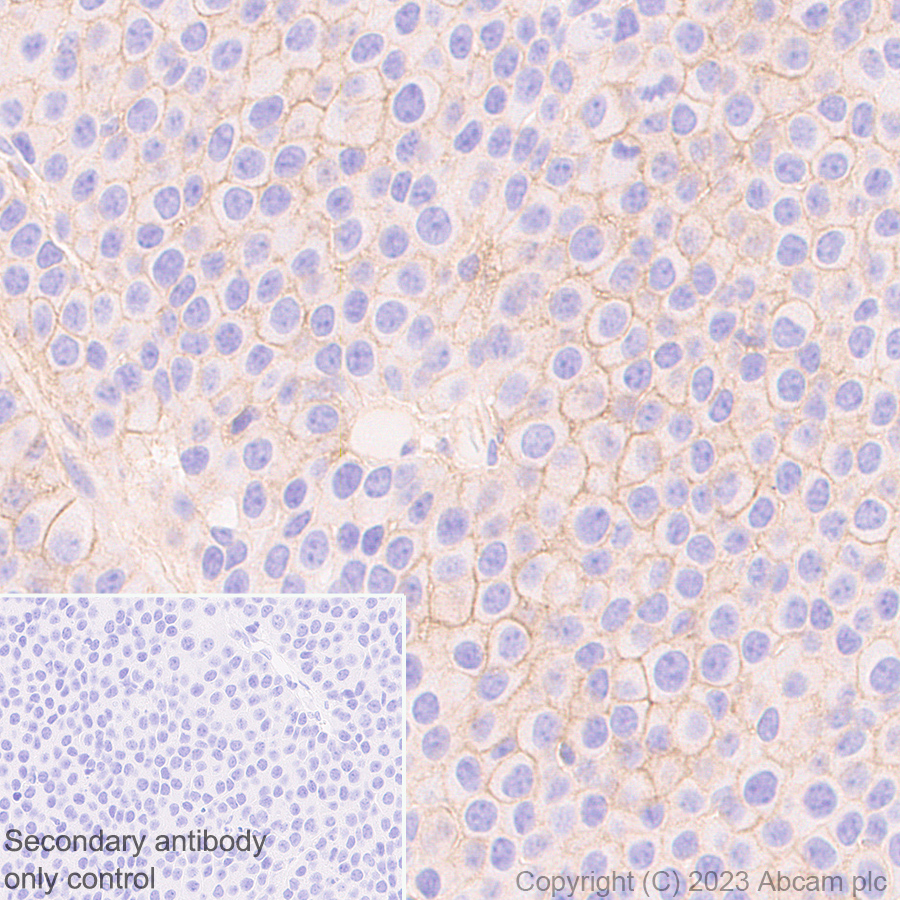 Immunohistochemistry (Formalin/PFA-fixed paraffin-embedded sections) - Anti-CD276 antibody [EPR27429-173] - BSA and Azide free (ab313381), expandable thumbnail