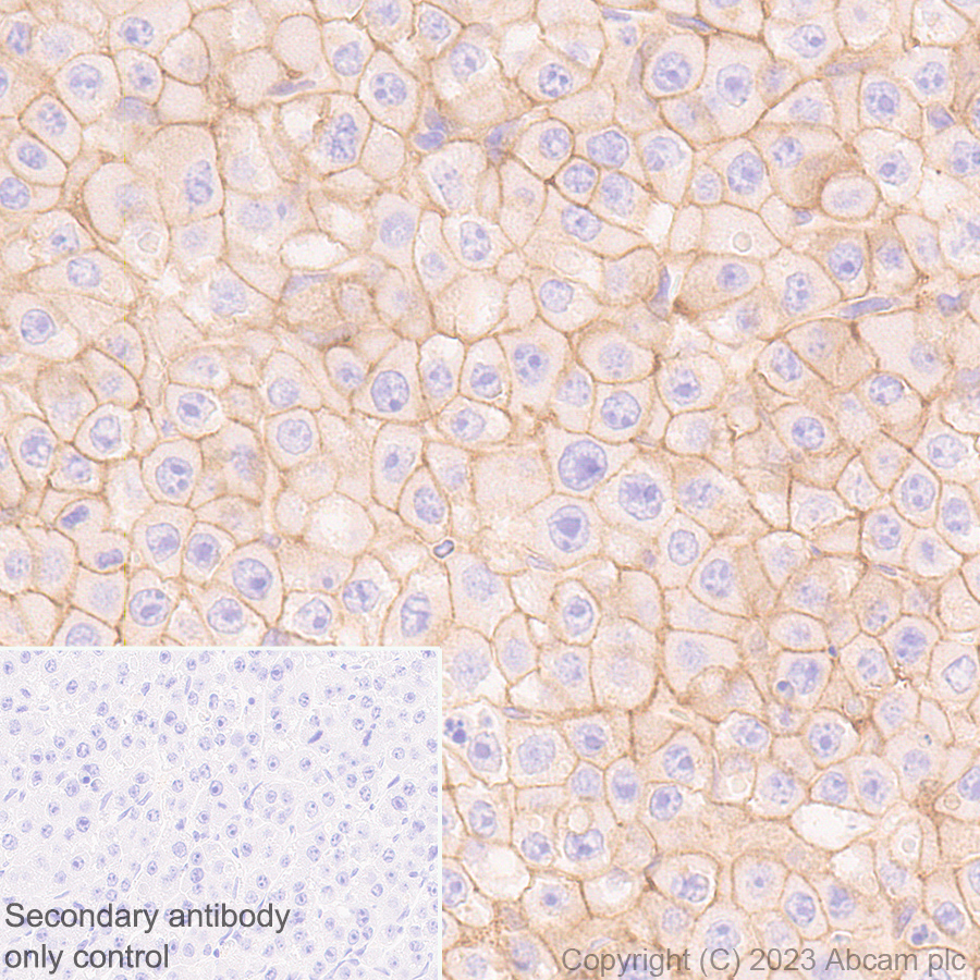 Immunohistochemistry (Formalin/PFA-fixed paraffin-embedded sections) - Anti-CD276 antibody [EPR27429-173] - BSA and Azide free (ab313381), expandable thumbnail