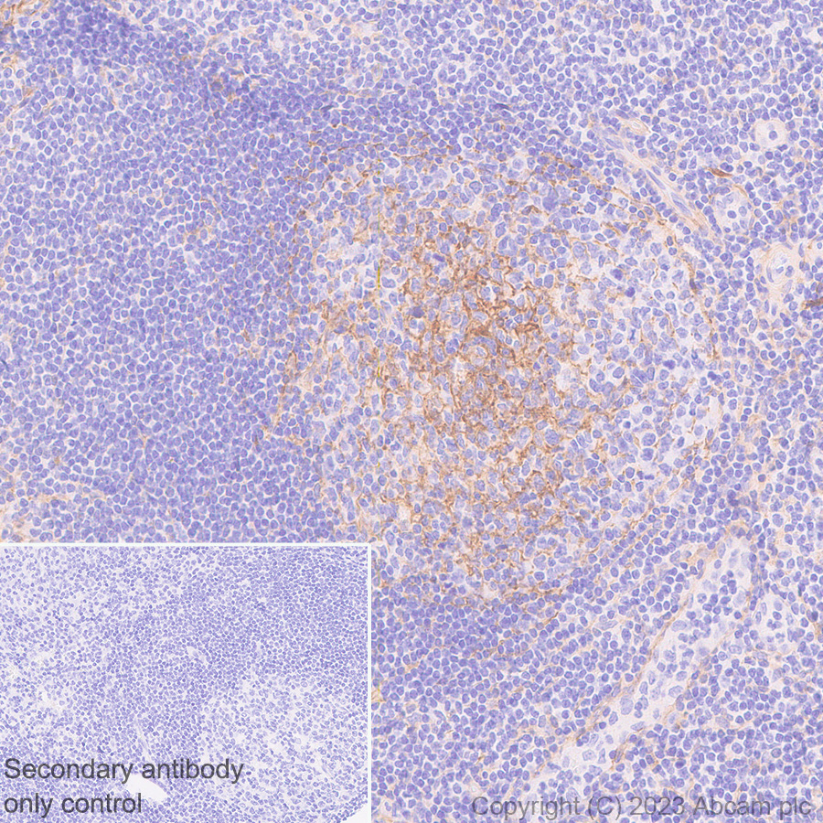 Immunohistochemistry (Formalin/PFA-fixed paraffin-embedded sections) - Anti-CD276 antibody [EPR27429-173] - BSA and Azide free (ab313381), expandable thumbnail