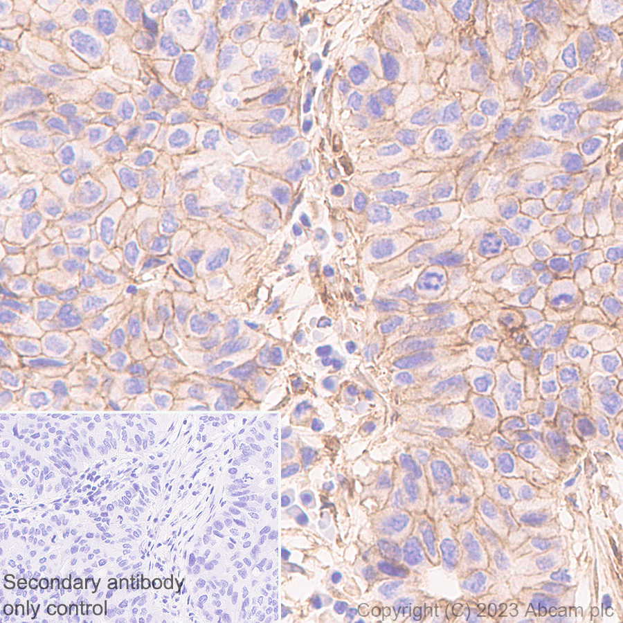 Immunohistochemistry (Formalin/PFA-fixed paraffin-embedded sections) - Anti-CD276 antibody [EPR27429-173] - BSA and Azide free (AB313381), expandable thumbnail
