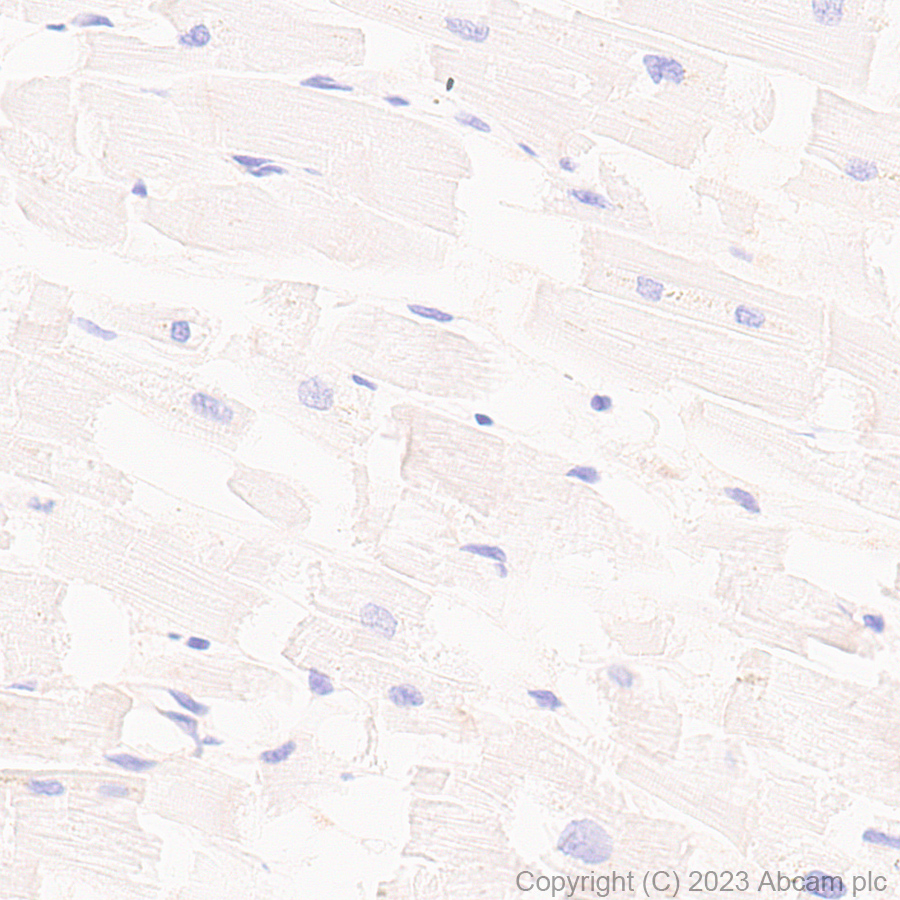 Immunohistochemistry (Formalin/PFA-fixed paraffin-embedded sections) - Anti-CD276 antibody [EPR27429-173] - BSA and Azide free (AB313381), expandable thumbnail