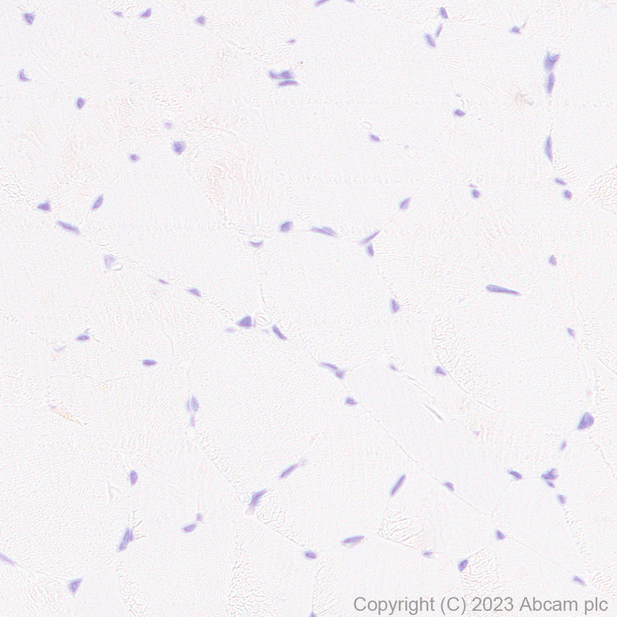 Immunohistochemistry (Formalin/PFA-fixed paraffin-embedded sections) - Anti-CD276 antibody [EPR27429-173] - BSA and Azide free (AB313381), expandable thumbnail