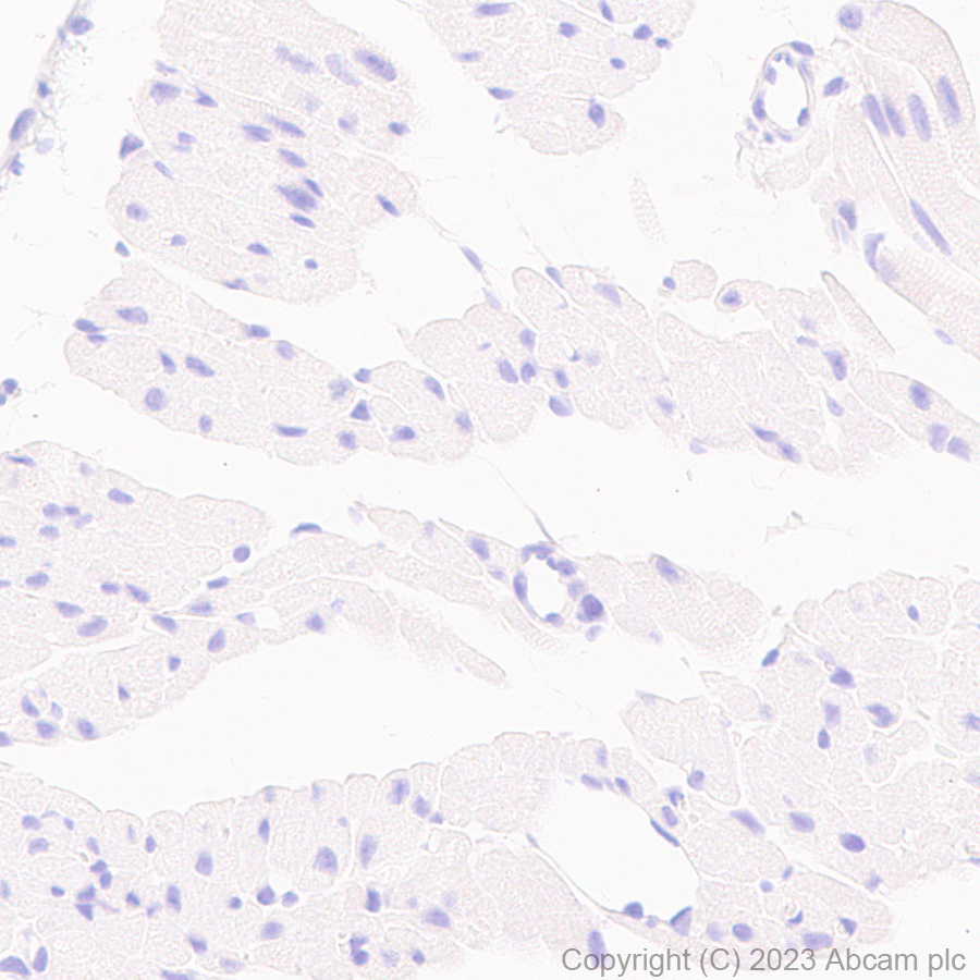 Immunohistochemistry (Formalin/PFA-fixed paraffin-embedded sections) - Anti-CD276 antibody [EPR27429-173] - BSA and Azide free (AB313381), expandable thumbnail