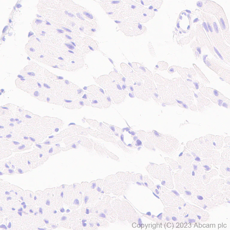 Immunohistochemistry (Formalin/PFA-fixed paraffin-embedded sections) - Anti-CD276 antibody [EPR27429-173] - BSA and Azide free (AB313381)