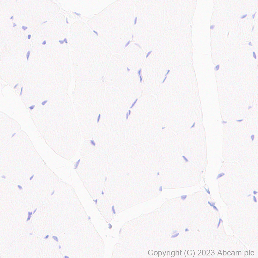 Immunohistochemistry (Formalin/PFA-fixed paraffin-embedded sections) - Anti-CD276 antibody [EPR27429-173] - BSA and Azide free (AB313381), expandable thumbnail