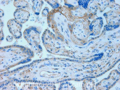 Immunohistochemistry (Formalin/PFA-fixed paraffin-embedded sections) - Anti-CD276 antibody [MM0104-20J12] (AB89133), expandable thumbnail