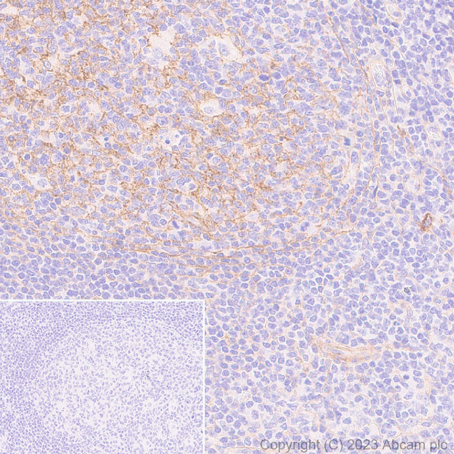 Immunohistochemistry (Formalin/PFA-fixed paraffin-embedded sections) - Anti-CD276 antibody [RM2041] (ab315907), expandable thumbnail