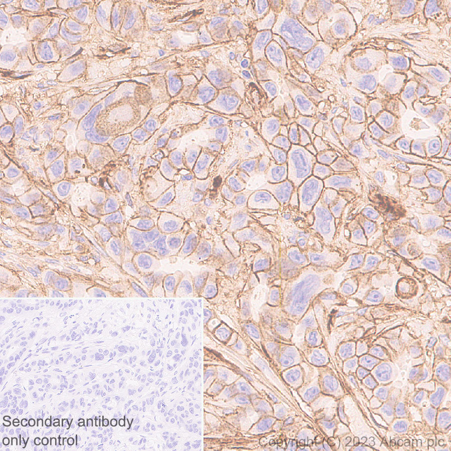 Immunohistochemistry (Formalin/PFA-fixed paraffin-embedded sections) - Anti-CD276 antibody [RM2041] (ab315907), expandable thumbnail