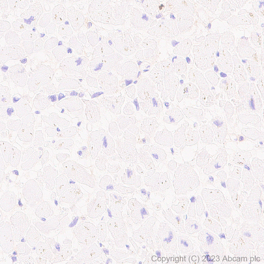Immunohistochemistry (Formalin/PFA-fixed paraffin-embedded sections) - Anti-CD276 antibody [RM2041] (ab315907), expandable thumbnail