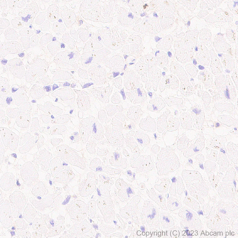Immunohistochemistry (Formalin/PFA-fixed paraffin-embedded sections) - Anti-CD276 antibody [RM2041] (AB315907)