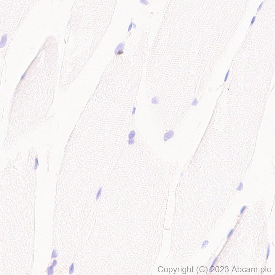 Immunohistochemistry (Formalin/PFA-fixed paraffin-embedded sections) - Anti-CD276 antibody [RM2041] (ab315907), expandable thumbnail