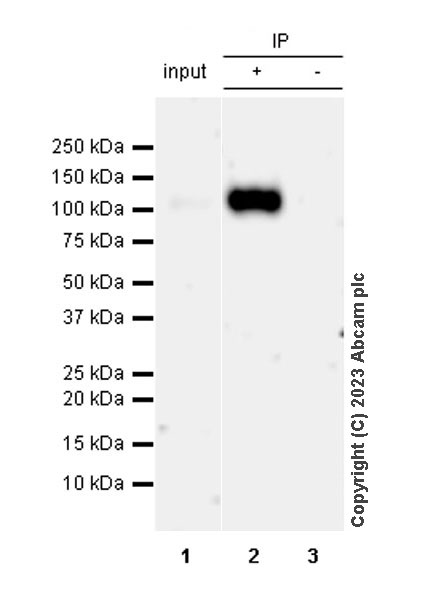 Immunoprecipitation - Anti-CD276 antibody [RM2041] (AB315907), expandable thumbnail