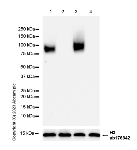 Western blot - Anti-CD276 antibody [RM2041] (ab315907), expandable thumbnail