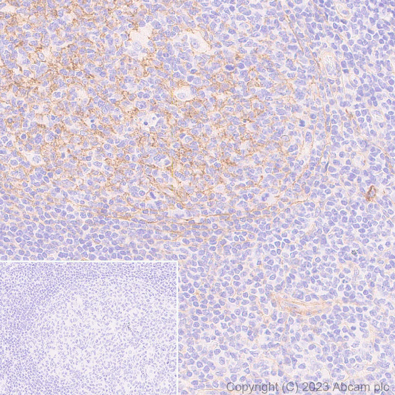 Immunohistochemistry (Formalin/PFA-fixed paraffin-embedded sections) - Anti-CD276 antibody [RM2041] - BSA and Azide free (AB315908)