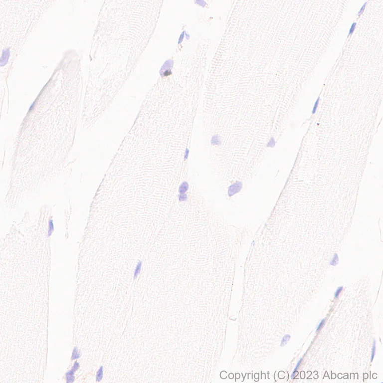 Immunohistochemistry (Formalin/PFA-fixed paraffin-embedded sections) - Anti-CD276 antibody [RM2041] - BSA and Azide free (AB315908)