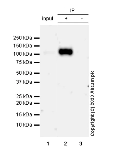 Immunoprecipitation - Anti-CD276 antibody [RM2041] - BSA and Azide free (AB315908)