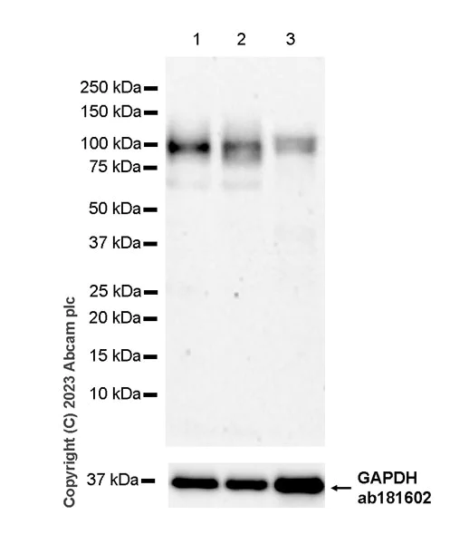 Western blot - Anti-CD276 antibody [RM2041] - BSA and Azide free (AB315908)