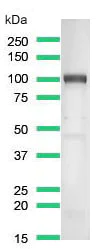 Western blot - Anti-CD276 antibody [SP206] (AB227670)