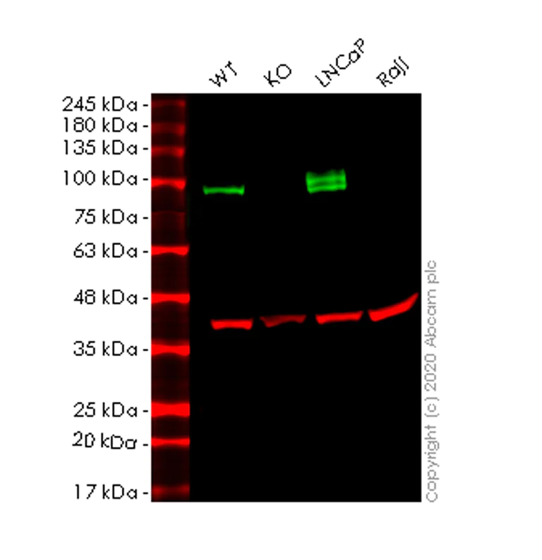 Western blot - Anti-CD276 antibody [SP206] (AB227670)