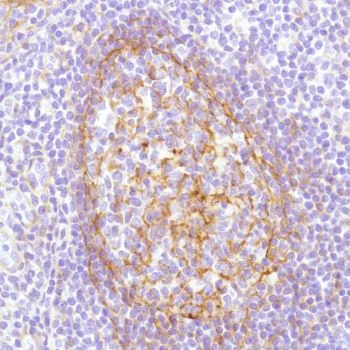 Immunohistochemistry (Formalin/PFA-fixed paraffin-embedded sections) - Anti-CD276 antibody [SP206] - BSA and Azide free (AB240407)