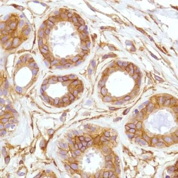 Immunohistochemistry (Formalin/PFA-fixed paraffin-embedded sections) - Anti-CD276 antibody [SP206] - BSA and Azide free (AB240407)