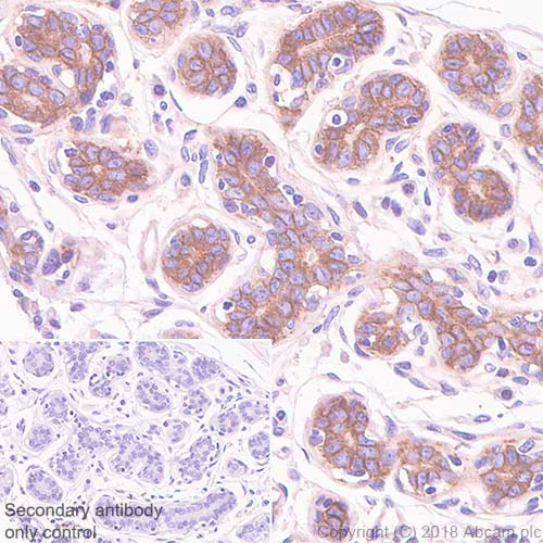 Immunohistochemistry (Formalin/PFA-fixed paraffin-embedded sections) - Anti-CD276 antibody [SP206] - BSA and Azide free (AB240407)