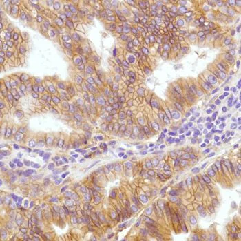 Immunohistochemistry (Formalin/PFA-fixed paraffin-embedded sections) - Anti-CD276 antibody [SP206] - BSA and Azide free (AB240407)