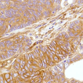 Immunohistochemistry (Formalin/PFA-fixed paraffin-embedded sections) - Anti-CD276 antibody [SP206] - BSA and Azide free (AB240407)