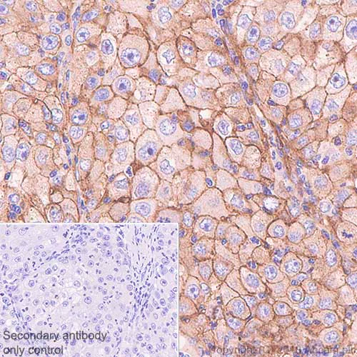 Immunohistochemistry (Formalin/PFA-fixed paraffin-embedded sections) - Anti-CD276 antibody [SP206] - BSA and Azide free (AB240407)