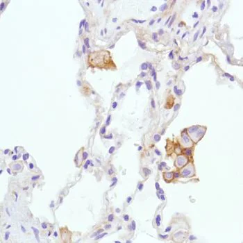 Immunohistochemistry (Formalin/PFA-fixed paraffin-embedded sections) - Anti-CD276 antibody [SP206] - Low endotoxin, Azide free (AB246794)