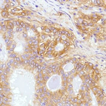 Immunohistochemistry (Formalin/PFA-fixed paraffin-embedded sections) - Anti-CD276 antibody [SP206] - Low endotoxin, Azide free (AB246794)