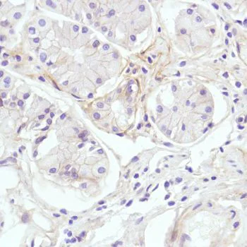 Immunohistochemistry (Formalin/PFA-fixed paraffin-embedded sections) - Anti-CD276 antibody [SP206] - Low endotoxin, Azide free (AB246794)