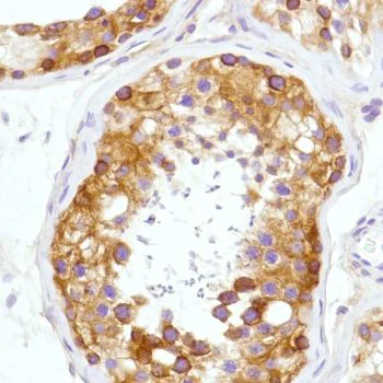 Immunohistochemistry (Formalin/PFA-fixed paraffin-embedded sections) - Anti-CD276 antibody [SP206] - Low endotoxin, Azide free (AB246794)