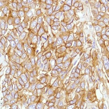 Immunohistochemistry (Formalin/PFA-fixed paraffin-embedded sections) - Anti-CD276 antibody [SP206] - Low endotoxin, Azide free (AB246794)