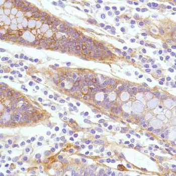 Immunohistochemistry (Formalin/PFA-fixed paraffin-embedded sections) - Anti-CD276 antibody [SP206] - Low endotoxin, Azide free (AB246794)
