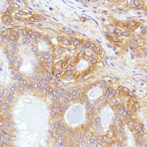 Immunohistochemistry (Formalin/PFA-fixed paraffin-embedded sections) - Anti-CD276 antibody [SP206], prediluted (AB228178)