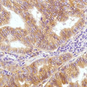 Immunohistochemistry (Formalin/PFA-fixed paraffin-embedded sections) - Anti-CD276 antibody [SP206], prediluted (AB228178)