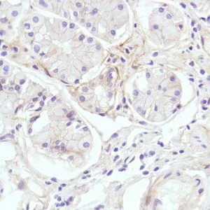 Immunohistochemistry (Formalin/PFA-fixed paraffin-embedded sections) - Anti-CD276 antibody [SP206], prediluted (AB228178)