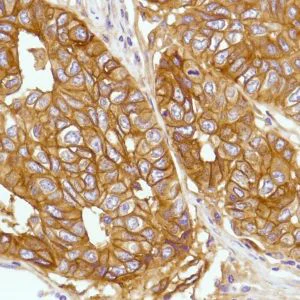 Immunohistochemistry (Formalin/PFA-fixed paraffin-embedded sections) - Anti-CD276 antibody [SP206], prediluted (AB228178)