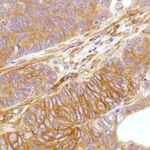 Immunohistochemistry (Formalin/PFA-fixed paraffin-embedded sections) - Anti-CD276 antibody [SP206], prediluted (AB228178)