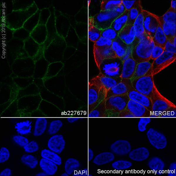 Immunocytochemistry/ Immunofluorescence - Anti-CD276 antibody [SP265] - BSA and Azide free (AB272011), expandable thumbnail