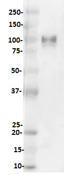 Western blot - Anti-CD276 antibody [SP265] - BSA and Azide free (AB272011)